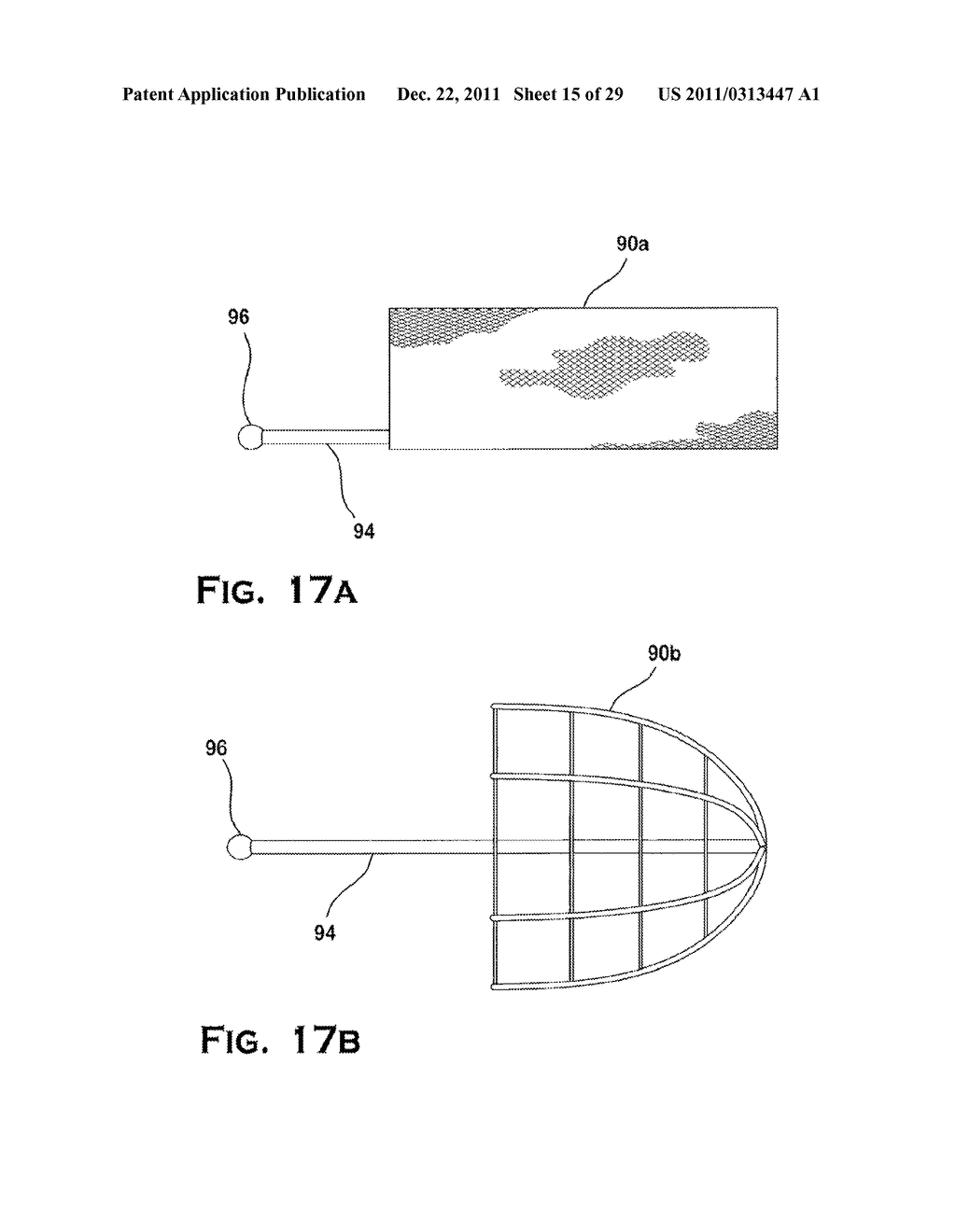 SYSTEM AND METHOD FOR MECHANICALLY POSITIONING INTRAVASCULAR IMPLANTS - diagram, schematic, and image 16