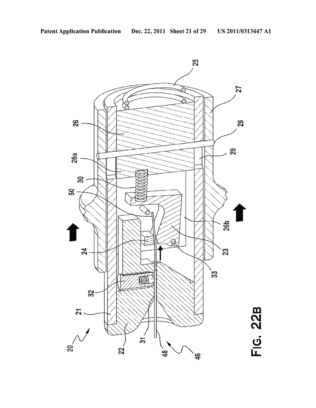 SYSTEM AND METHOD FOR MECHANICALLY POSITIONING INTRAVASCULAR IMPLANTS - diagram, schematic, and image 22