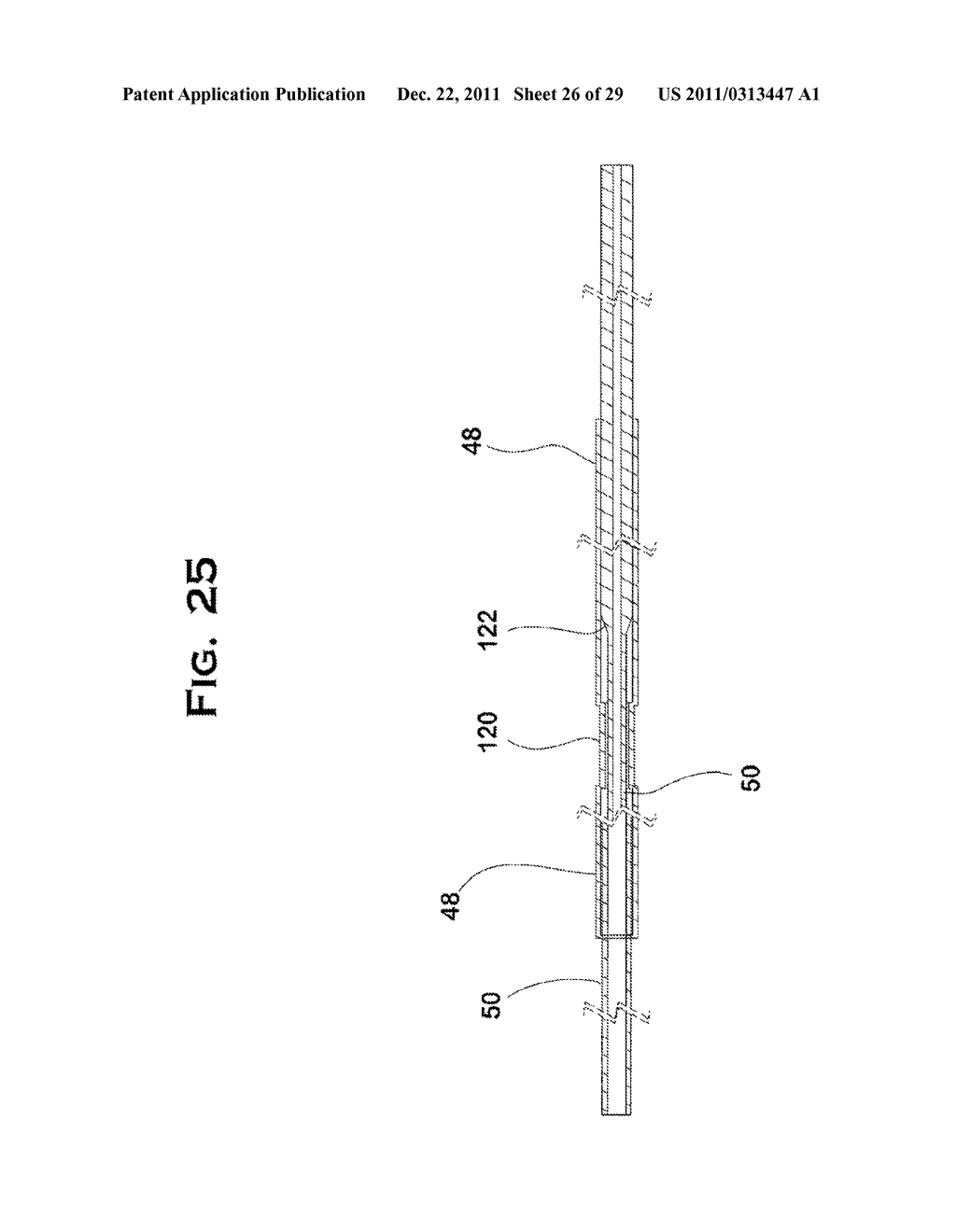 SYSTEM AND METHOD FOR MECHANICALLY POSITIONING INTRAVASCULAR IMPLANTS - diagram, schematic, and image 27