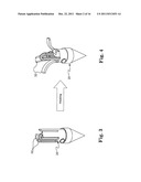 BONE ANCHOR COMPRISING A SHAPE MEMORY ELEMENT AND UTILIZING TEMPERATURE     TRANSITION TO SECURE THE BONE ANCHOR IN BONE diagram and image