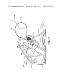 BONE ANCHOR COMPRISING A SHAPE MEMORY ELEMENT AND UTILIZING TEMPERATURE     TRANSITION TO SECURE THE BONE ANCHOR IN BONE diagram and image