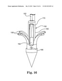 BONE ANCHOR COMPRISING A SHAPE MEMORY ELEMENT AND UTILIZING TEMPERATURE     TRANSITION TO SECURE THE BONE ANCHOR IN BONE diagram and image