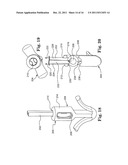 BONE ANCHOR COMPRISING A SHAPE MEMORY ELEMENT AND UTILIZING TEMPERATURE     TRANSITION TO SECURE THE BONE ANCHOR IN BONE diagram and image