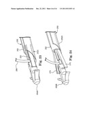 BONE ANCHOR COMPRISING A SHAPE MEMORY ELEMENT AND UTILIZING TEMPERATURE     TRANSITION TO SECURE THE BONE ANCHOR IN BONE diagram and image