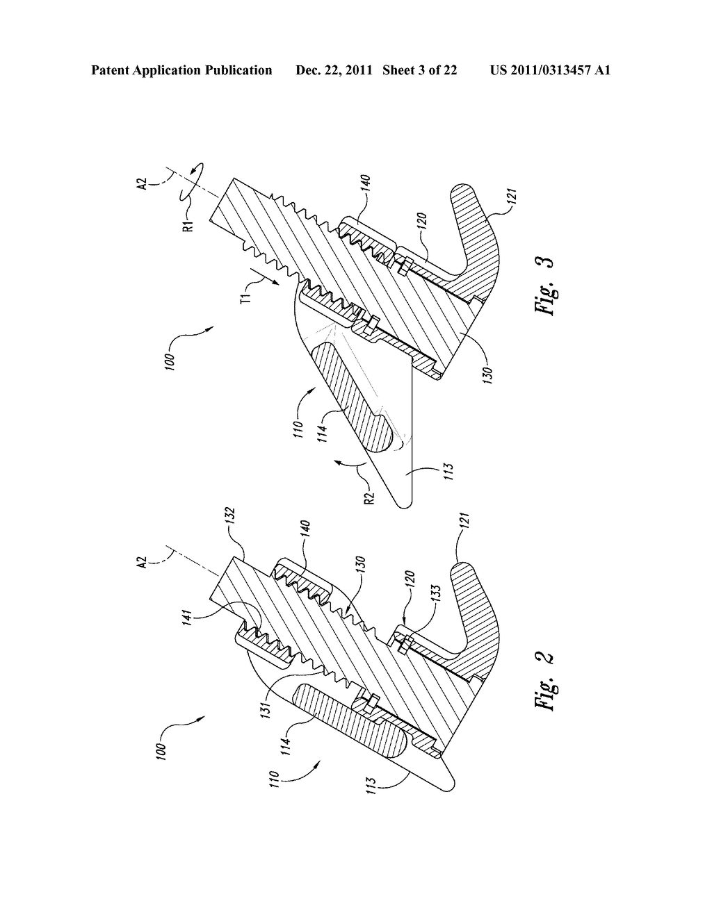 SPINAL SPACER FOR CERVICAL AND OTHER VERTEBRA, AND ASSOCIATED SYSTEMS AND     METHODS - diagram, schematic, and image 04