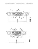 Dynamic Spine Stabilizer diagram and image