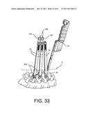 System for Percutaneously Fixing a Connecting Rod to a Spine diagram and image