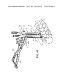 System for Percutaneously Fixing a Connecting Rod to a Spine diagram and image