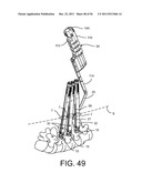 System for Percutaneously Fixing a Connecting Rod to a Spine diagram and image