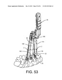 System for Percutaneously Fixing a Connecting Rod to a Spine diagram and image