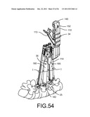 System for Percutaneously Fixing a Connecting Rod to a Spine diagram and image