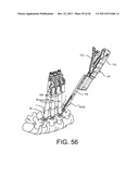 System for Percutaneously Fixing a Connecting Rod to a Spine diagram and image