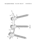 FLEXIBLE SPINAL STABILIZATION ELEMENT AND SYSTEM diagram and image