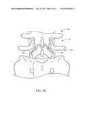 METHOD AND APPARATUS FOR SPINAL STABILIZATION diagram and image