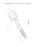 METHOD AND APPARATUS FOR SPINAL STABILIZATION diagram and image