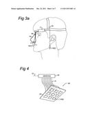 NOSE STIMULATOR FOR PRODUCING A STIMULATION SIGNAL TO A NOSE diagram and image