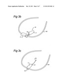 NOSE STIMULATOR FOR PRODUCING A STIMULATION SIGNAL TO A NOSE diagram and image