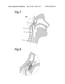 NOSE STIMULATOR FOR PRODUCING A STIMULATION SIGNAL TO A NOSE diagram and image