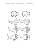 Devices and Methods for Vestibular and/or Cranial Nerve Stimulation diagram and image