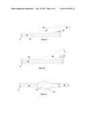 DEVICE AND METHOD TO PREVENT  OR TREAT OUTFLOW VEIN STENOSIS OF AN     ARTERIOVENOUS FISTULA CONSTRUCTED WITH A SYNTHETIC VASCULAR GRAFT diagram and image