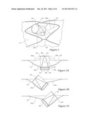 Side Branch Stent Graft diagram and image