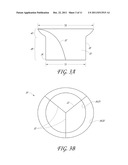 REPLACEMENT HEART VALVE diagram and image