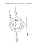 Pseudophakic Accommodating Intraocular Lens diagram and image