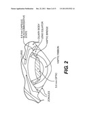 Pseudophakic Accommodating Intraocular Lens diagram and image