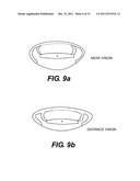 Pseudophakic Accommodating Intraocular Lens diagram and image