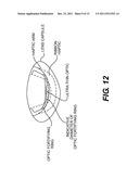 Pseudophakic Accommodating Intraocular Lens diagram and image