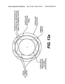 Pseudophakic Accommodating Intraocular Lens diagram and image