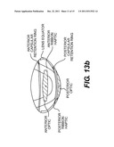 Pseudophakic Accommodating Intraocular Lens diagram and image