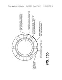 Pseudophakic Accommodating Intraocular Lens diagram and image