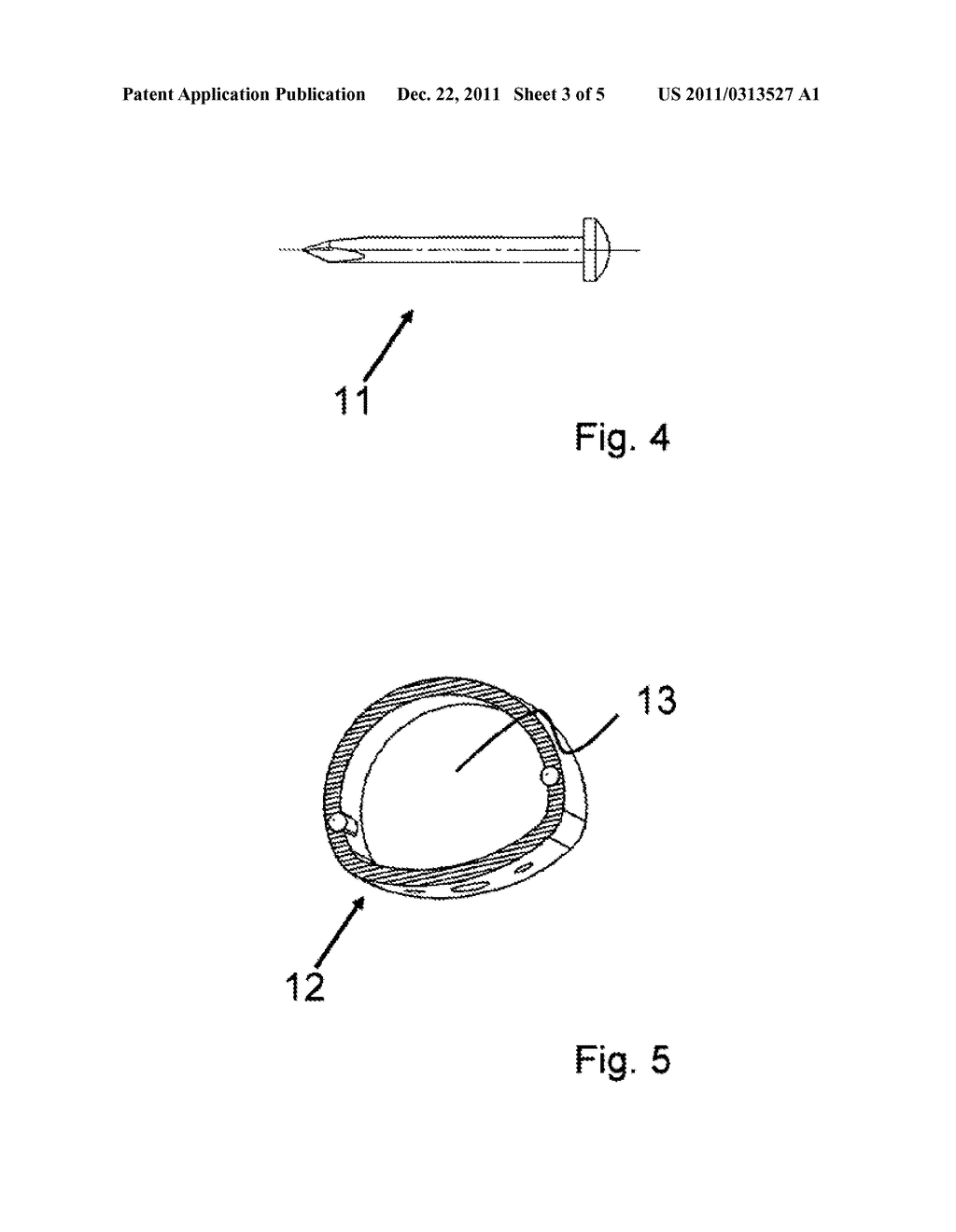 IMPLANT MADE OF A MAGNESIUM ALLOY AND METHOD FOR THE PRODUCTION THEREOF - diagram, schematic, and image 04