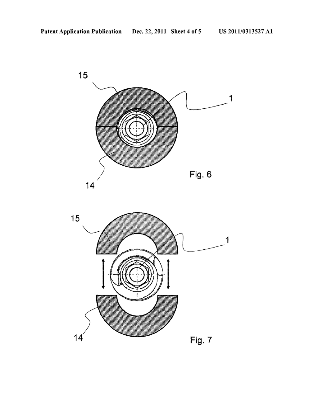 IMPLANT MADE OF A MAGNESIUM ALLOY AND METHOD FOR THE PRODUCTION THEREOF - diagram, schematic, and image 05