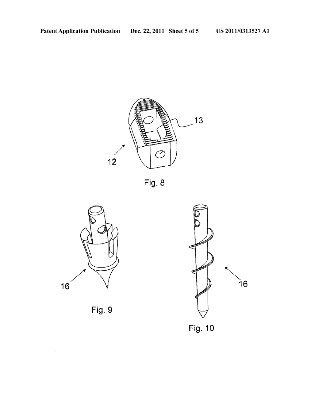 IMPLANT MADE OF A MAGNESIUM ALLOY AND METHOD FOR THE PRODUCTION THEREOF - diagram, schematic, and image 06