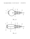 SUPPORT STRUCTURE IMPLANT FOR A BONE CAVITY diagram and image