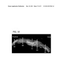 ENGINEERED BIOLOGICAL NERVE GRAFT, FABRICATION AND APPLICATION THEREOF diagram and image