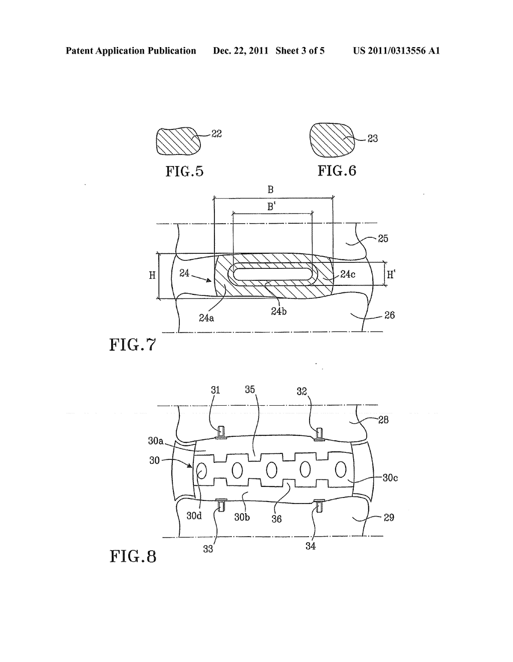 METHOD AND ARRANGEMENT AT IMPLANTS PREFERABLY FOR A HUMAN INTERVERTEBRAL     AND SUCH IMPLANT - diagram, schematic, and image 04