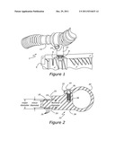 Grommet diagram and image