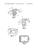 CLIPS FOR FASTENING ACCESSORIES TO VEHICLE PANELS diagram and image