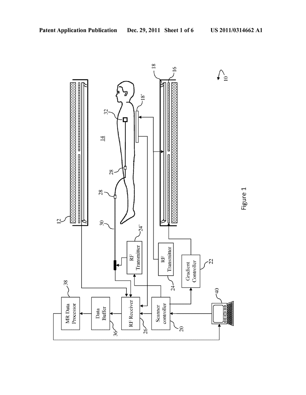 CONTINUOUS MECHANICAL TUNING OF TRANSFORMERS INSERTED IN RF-SAFE     TRANSMISSION LINES FOR INTERVENTIONAL MRI - diagram, schematic, and image 02