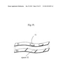 PRESSURE SENSOR WITH FIXED DEFORMABLE AREA diagram and image