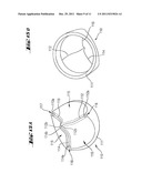 Casting Machine Valve, Dosing Chamber, and Casting Machine diagram and image