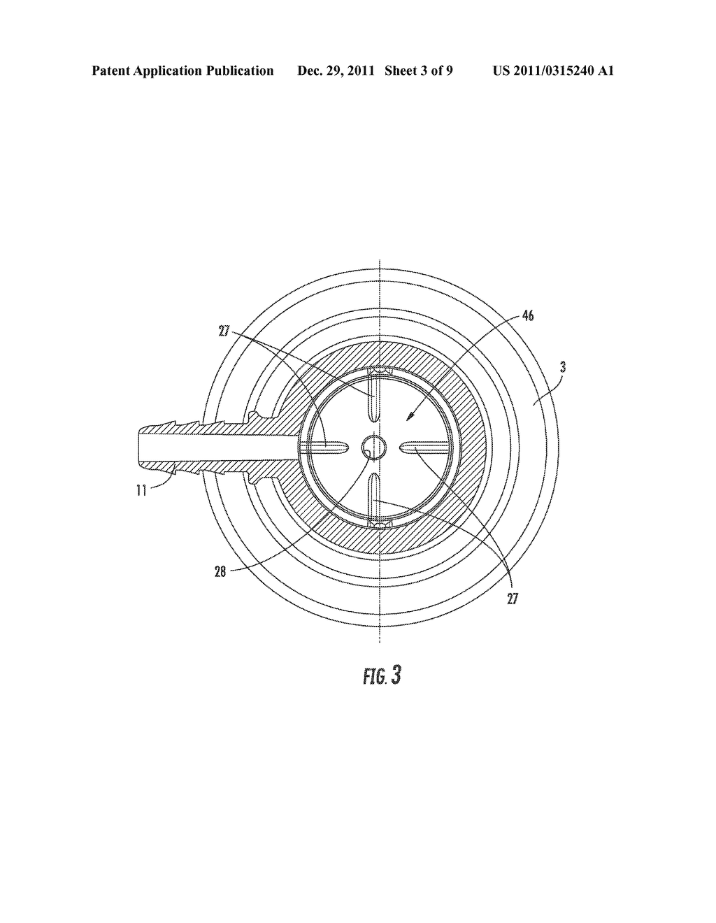 Ventilation valve - diagram, schematic, and image 04