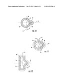 Ventilation valve diagram and image