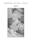 LOW DRAG ASYMMETRIC TETRAHEDRAL VORTEX GENERATORS diagram and image