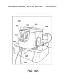 Portable Dialysis Machine diagram and image