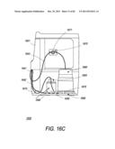 Portable Dialysis Machine diagram and image