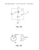 Portable Dialysis Machine diagram and image